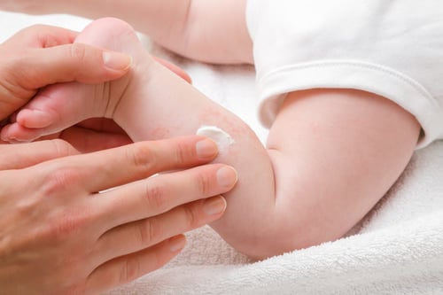 toolkit-header-Eczema-scaled